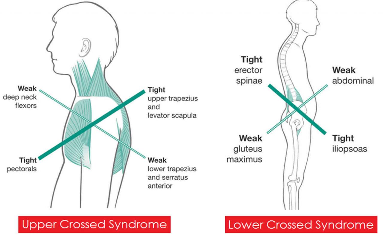 Hip imbalance pain problem names